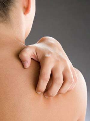 Psoriasis